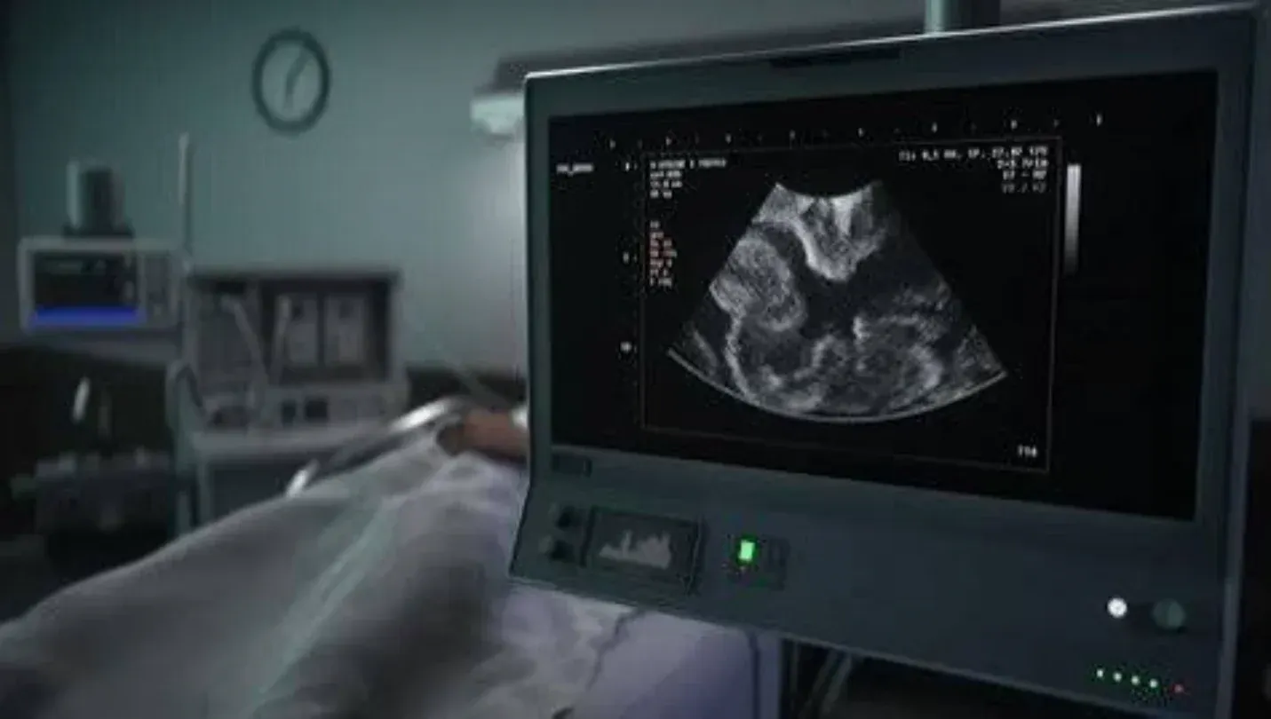 USG (Video X-ray)